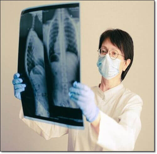 낭포성 섬유증 검사