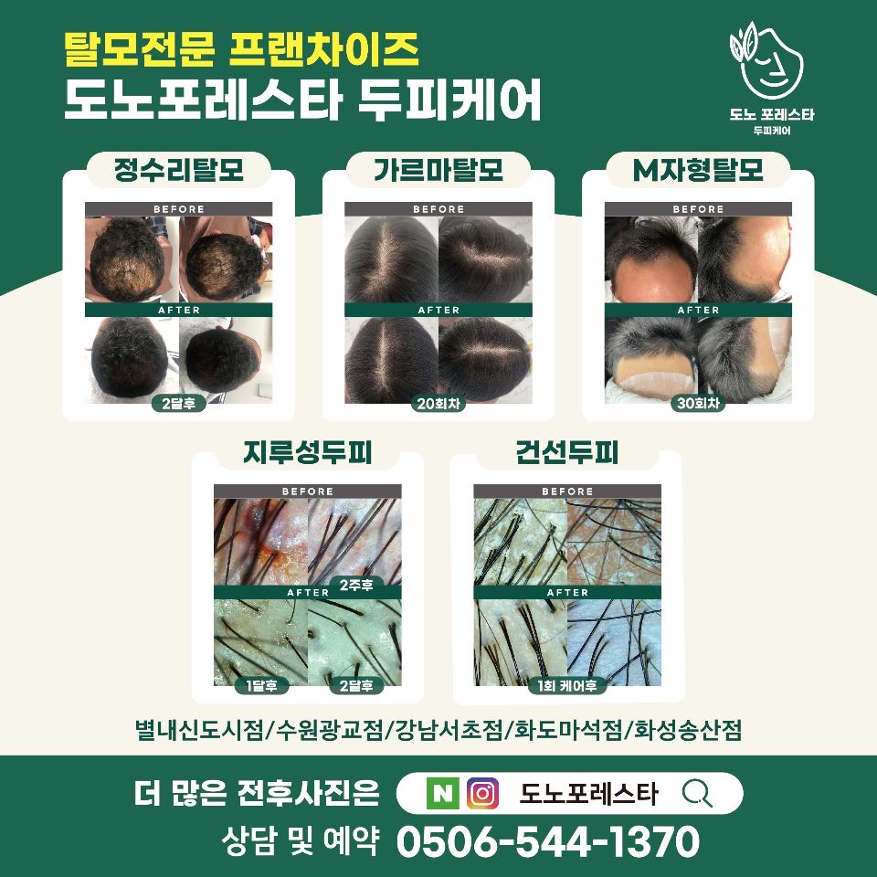 도노포레스타 두피케어 별내신도시점