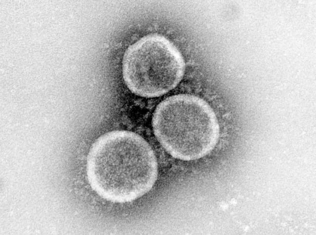 코로나19 바이러스