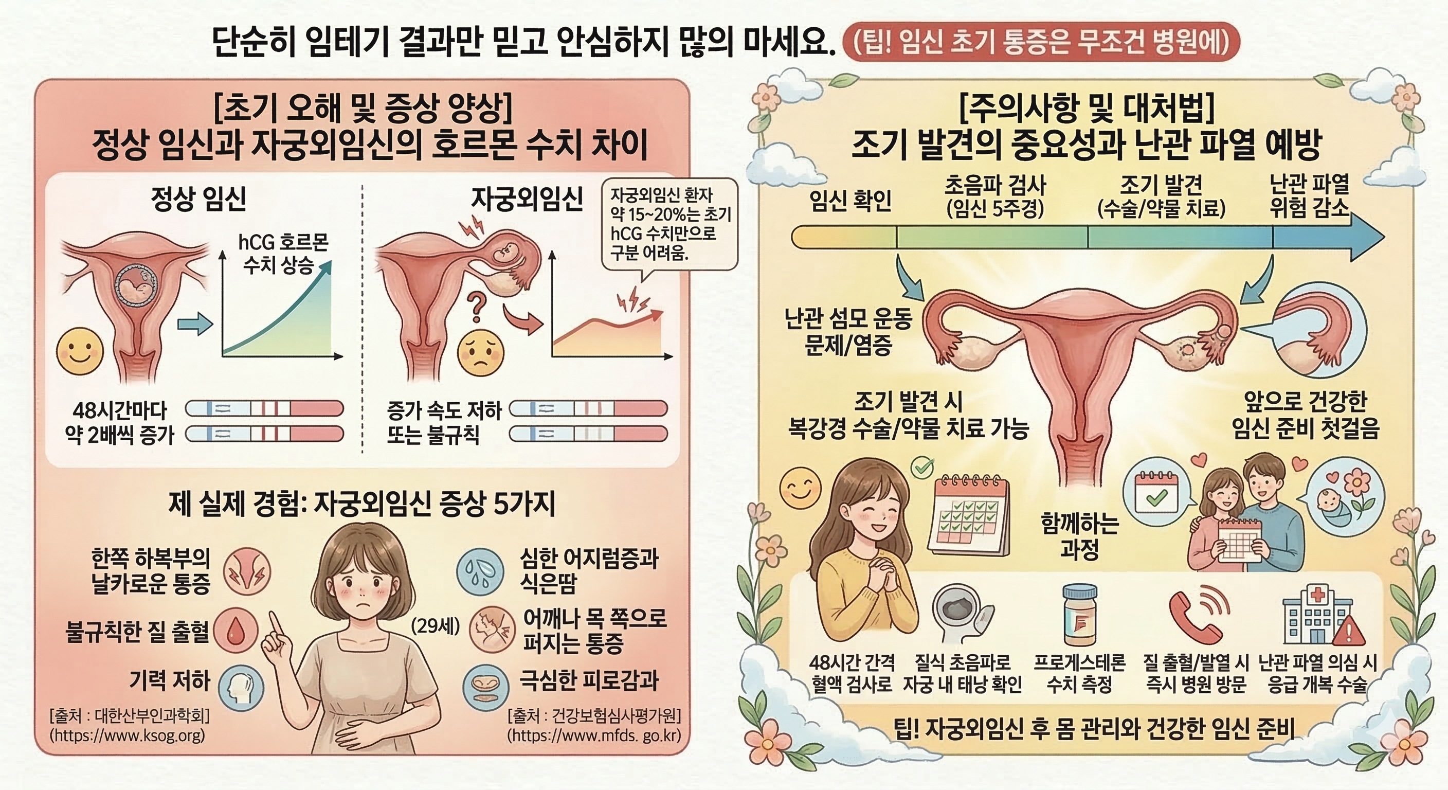 자궁외임신