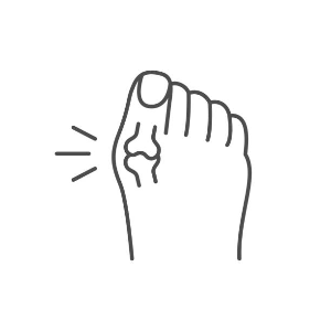 Why High Heels Cause Hallux Valgus Pain: Understanding Bunions.