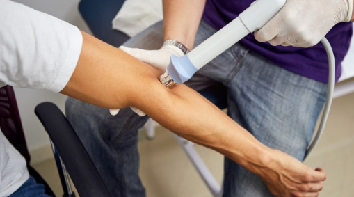 체외충격파치료