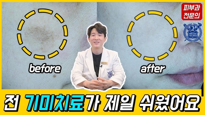 ๊ธฐ๋ฏธ ์์ ๋ ๋ฐฉ๋ฒ