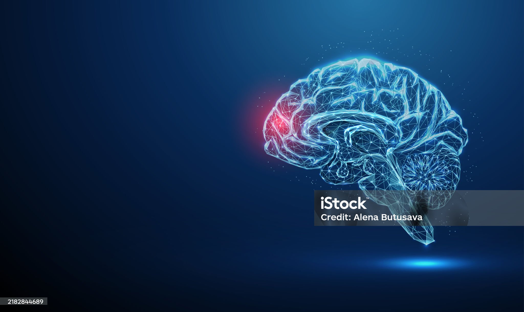 뇌졸중-관련-사진