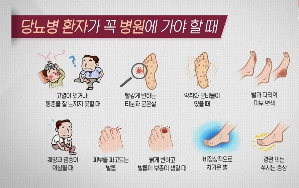EBS-명의-당뇨발-천동일-교수-족부-정형외과
