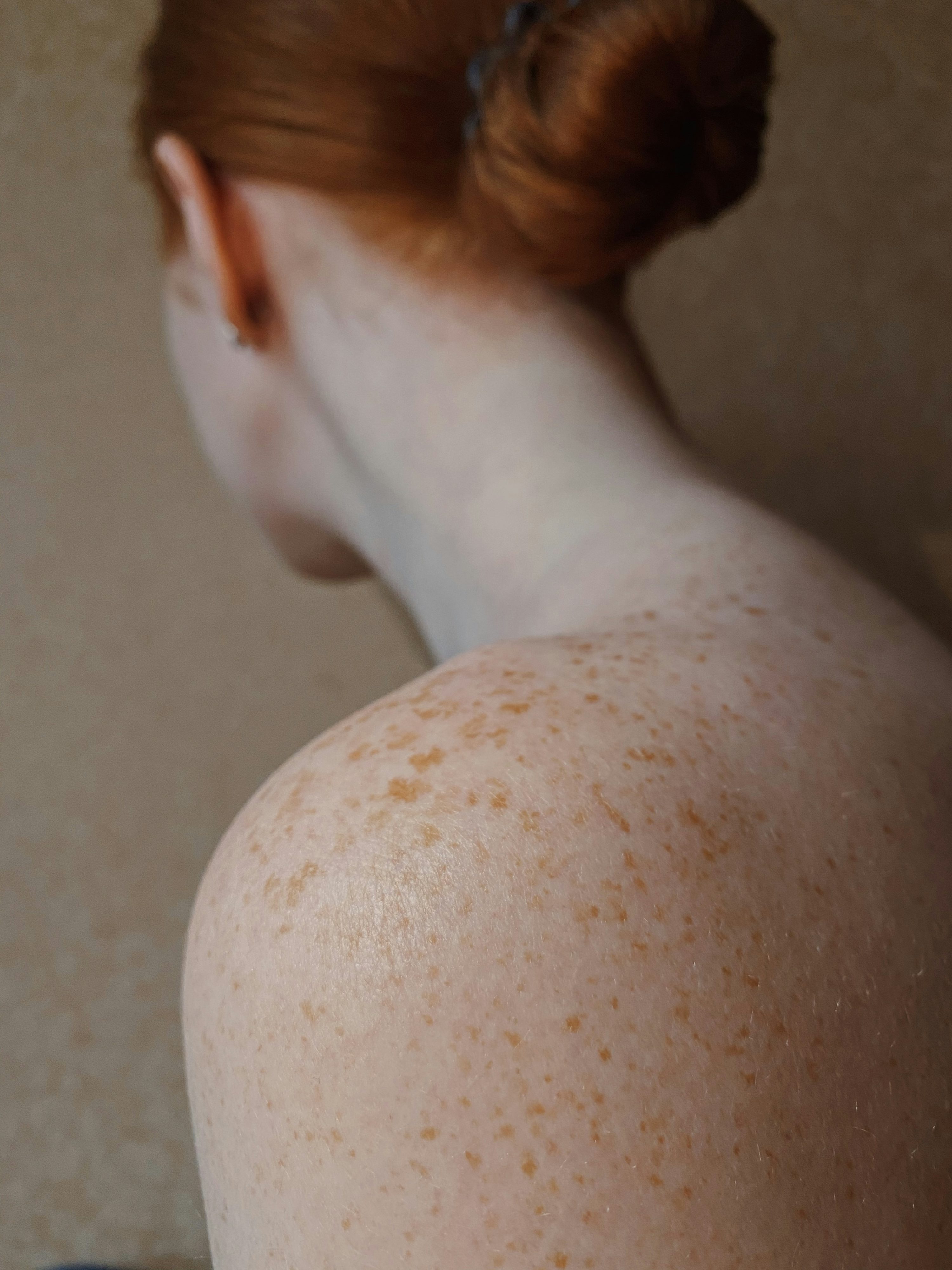 기미 없애는 방법