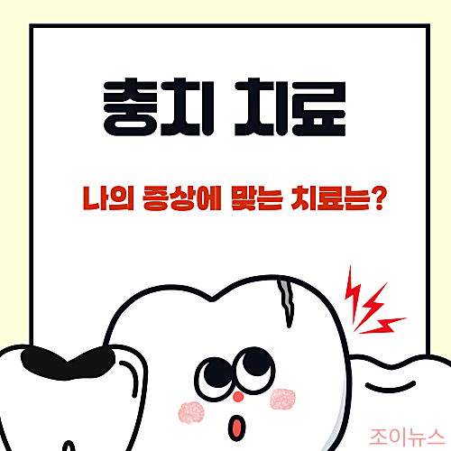 충치 치료, 나의 증상에 맞는 치료방법은?