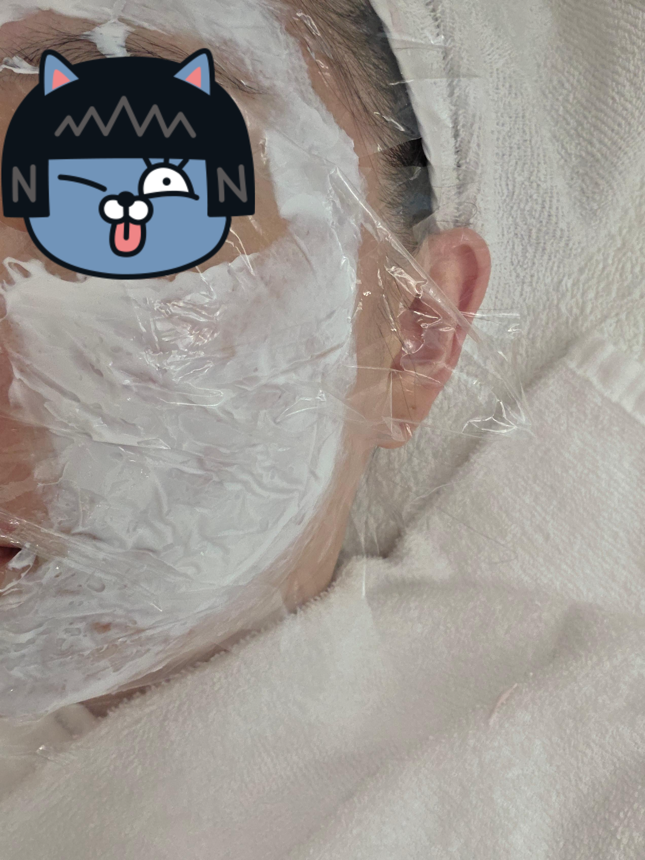 마취크림