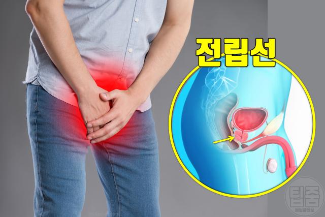 전립선 결석