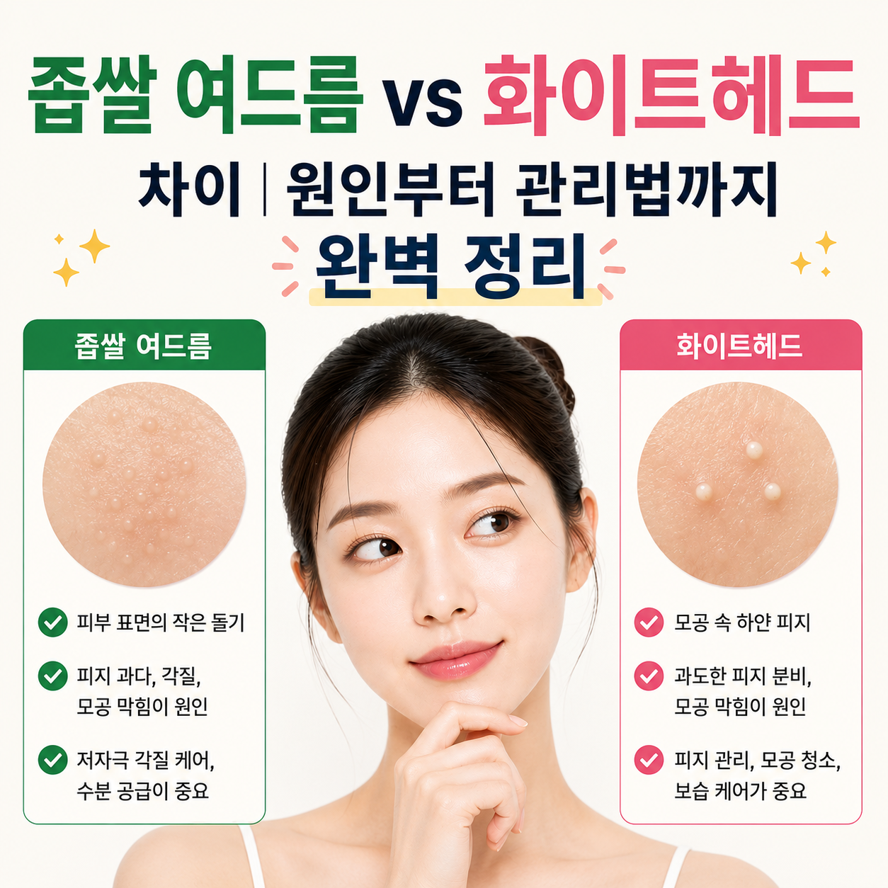 좁쌀 여드름 vs 화이트헤드 차이
