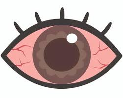 눈 실핏줄이 터지는 이유