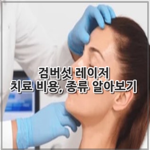 검버섯 레이저 치료 비용, 종류 알아보기