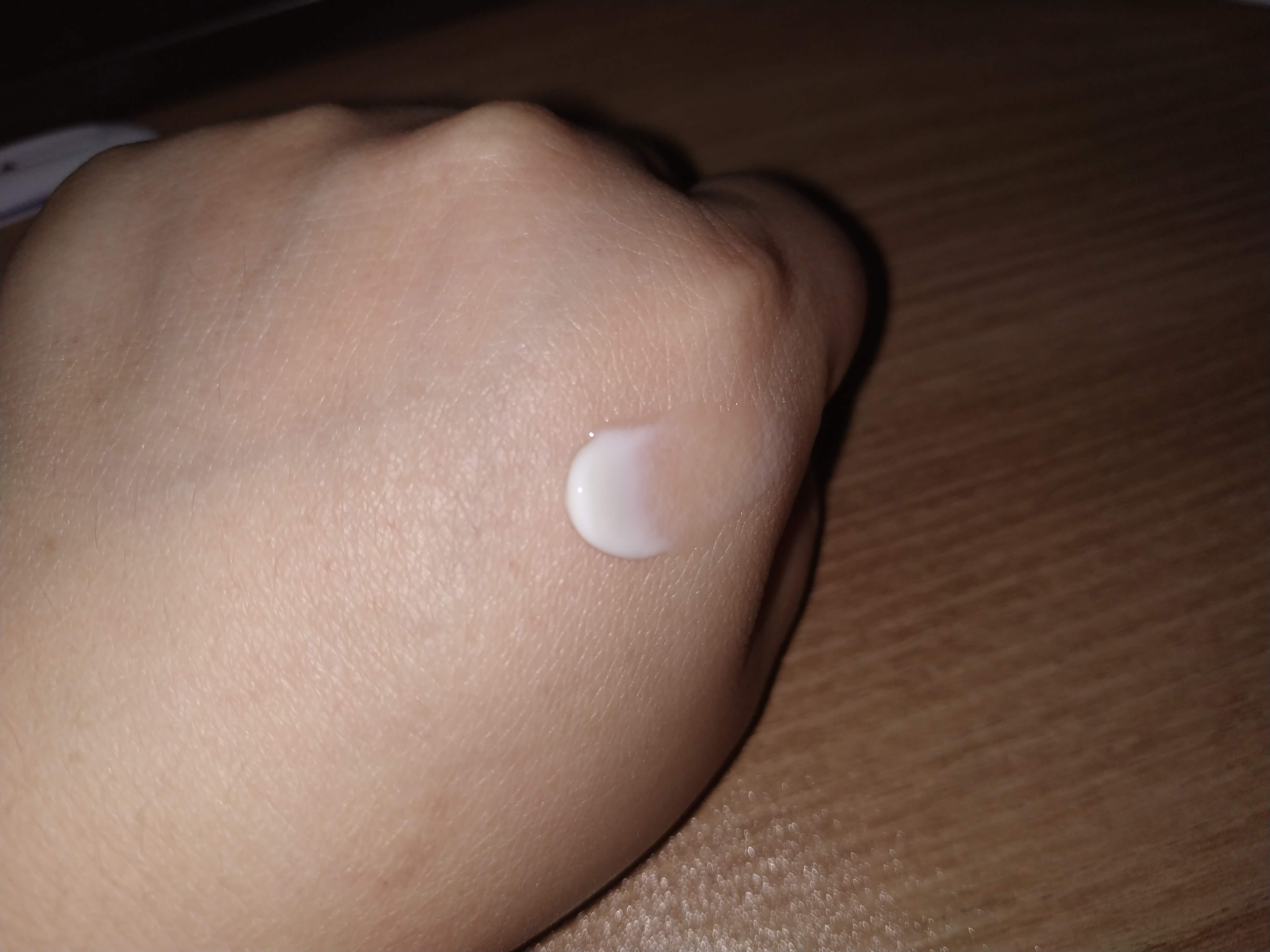 비판텐 연고를 손등에 발랐을 때