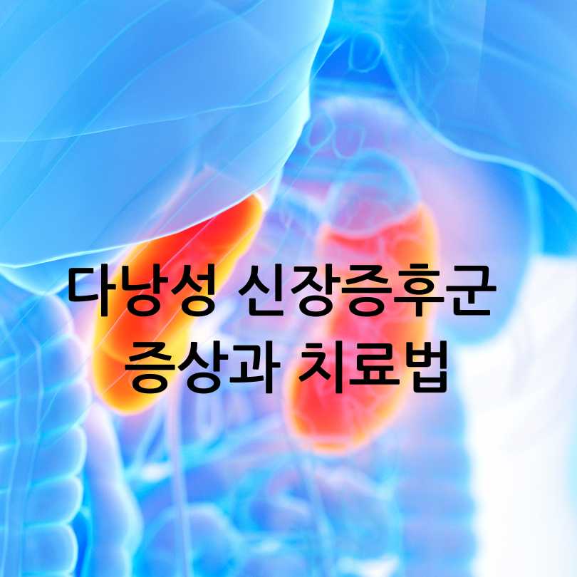 다낭성 신장증후군 증상과 치료법