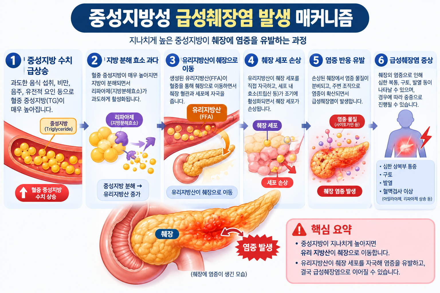 중성지방성 급성췌장염 발생 매커니즘 이미지