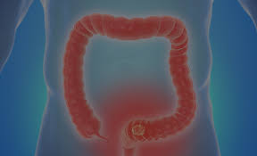 대장내시경 비용 총정리