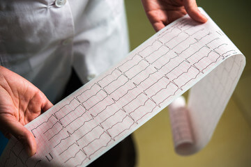 뇌경색 전조증상과 뇌졸중. 인간의 뇌는 우리 몸에서 가장 중요한 기관 중 하나입니다. 뇌를 통해 기억과 학습을 담당하고 신체 기관이 운동 기능을 수행할 수 있도록 하기 때문입니다. 뇌졸중과 뇌경색으로 심하게 손상되기 전까지는 일상생활에서 이상증상을 확인하기 어려우므로 평소에 주의를 하셔야 합니다.