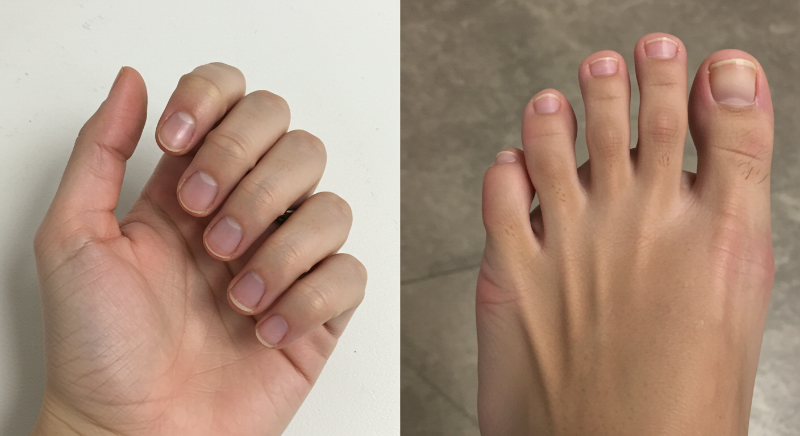 적절한 길이 유지