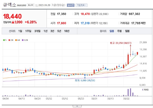 인공지능 로봇 관련주 큐렉소 주가 전망