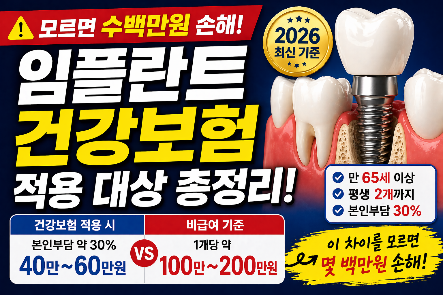 임플란트 건강보험 적용 대상