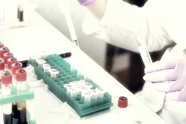 HLB제약 주가분석