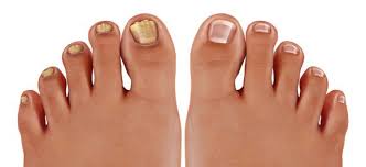 손톱 색깔로 보는 건강