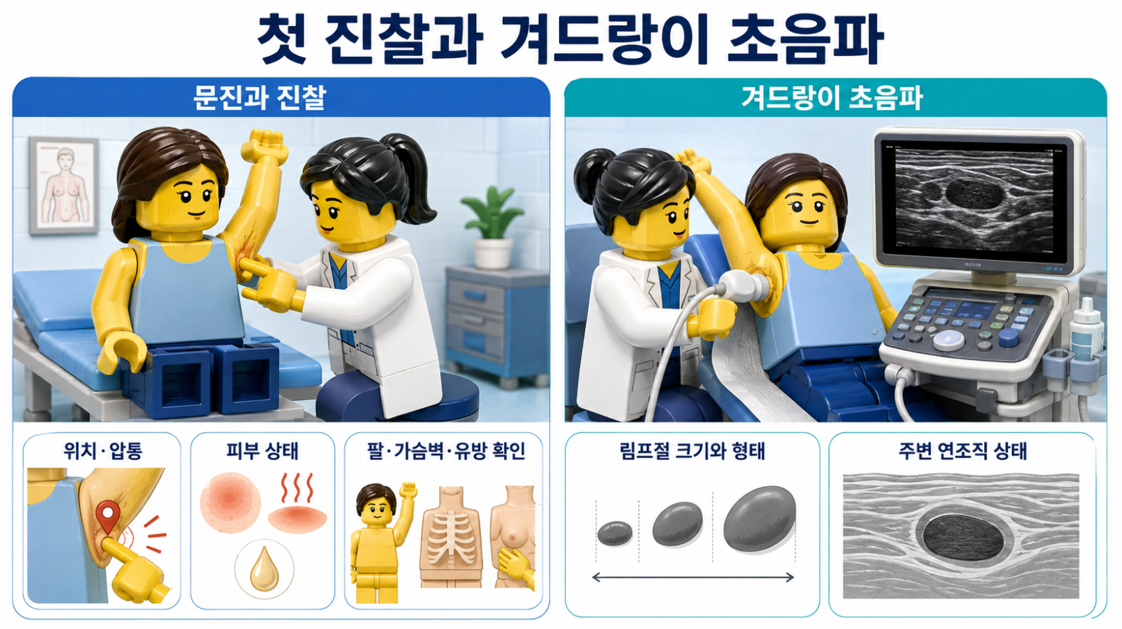 겨드랑이 멍울의 첫 진찰 과정과 겨드랑이 초음파로 확인하는 림프절&middot;연조직 상태