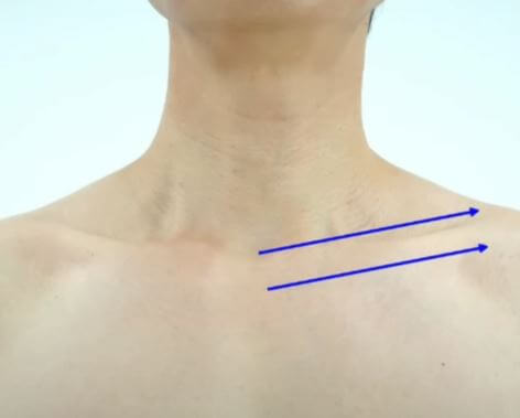 쇄골 림프절 위치