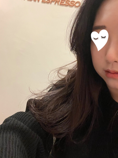 이중턱 보톡스 후기