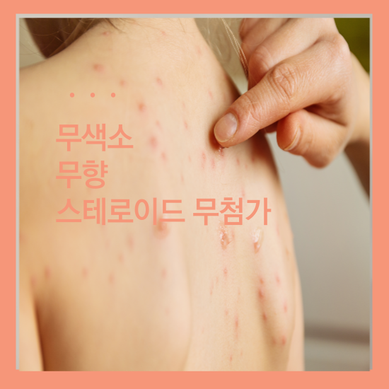 비판텐 연고