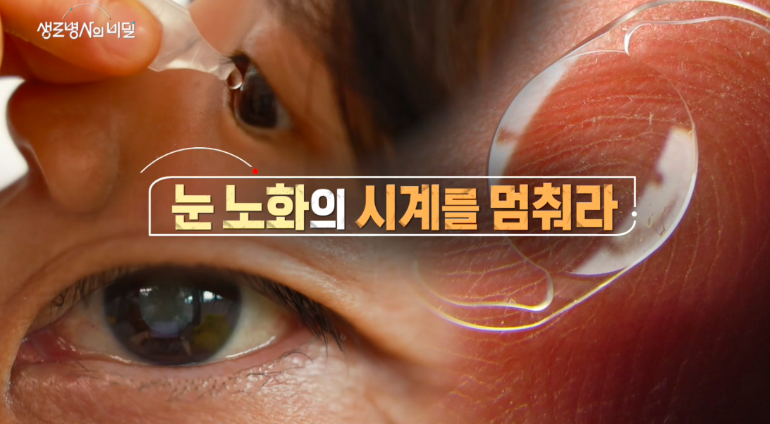 생로병사의비밀 눈노화