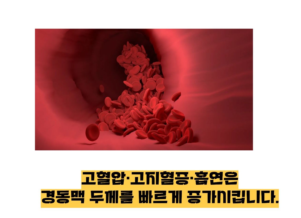 경동맥 두께 정상수치