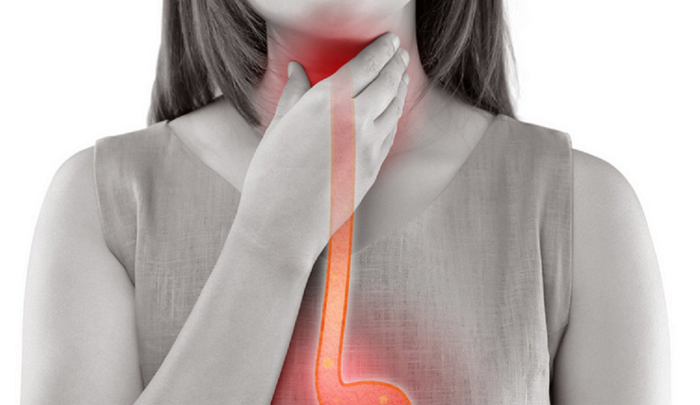 역류성 식도염 증상 위산 역류로 목과 식도 통증을 느끼는 모습