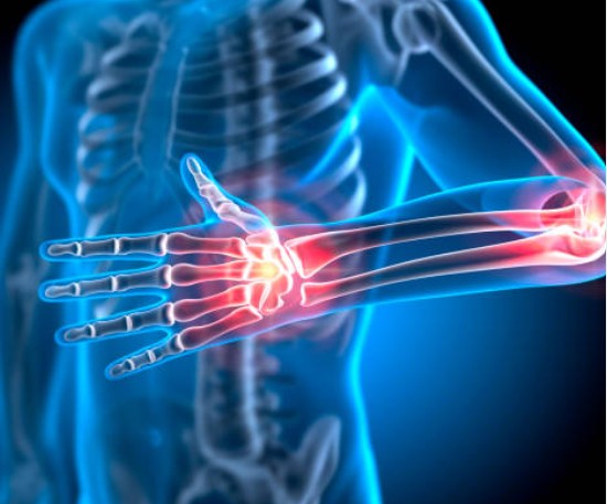 류마티스 환자 필독! 최신 관리 팁 (약물, 식이요법, 생활관리)