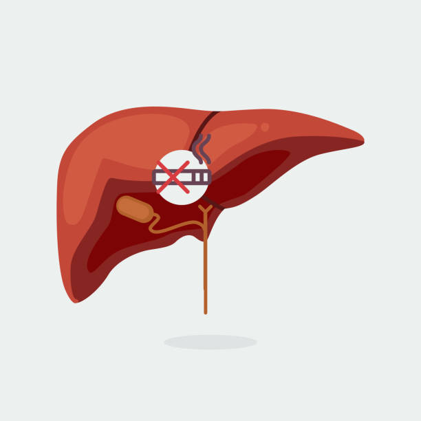 흡연 간수치 담배 전자 건강 지방간 간질환 발암 암 간세포 간암 간이식 췌장암 금연 원인