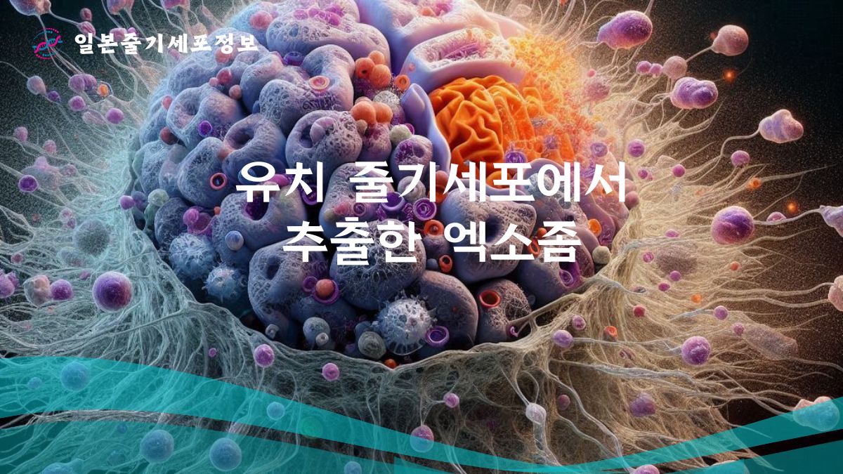 유치 줄기세포에서 추출한 엑소좀