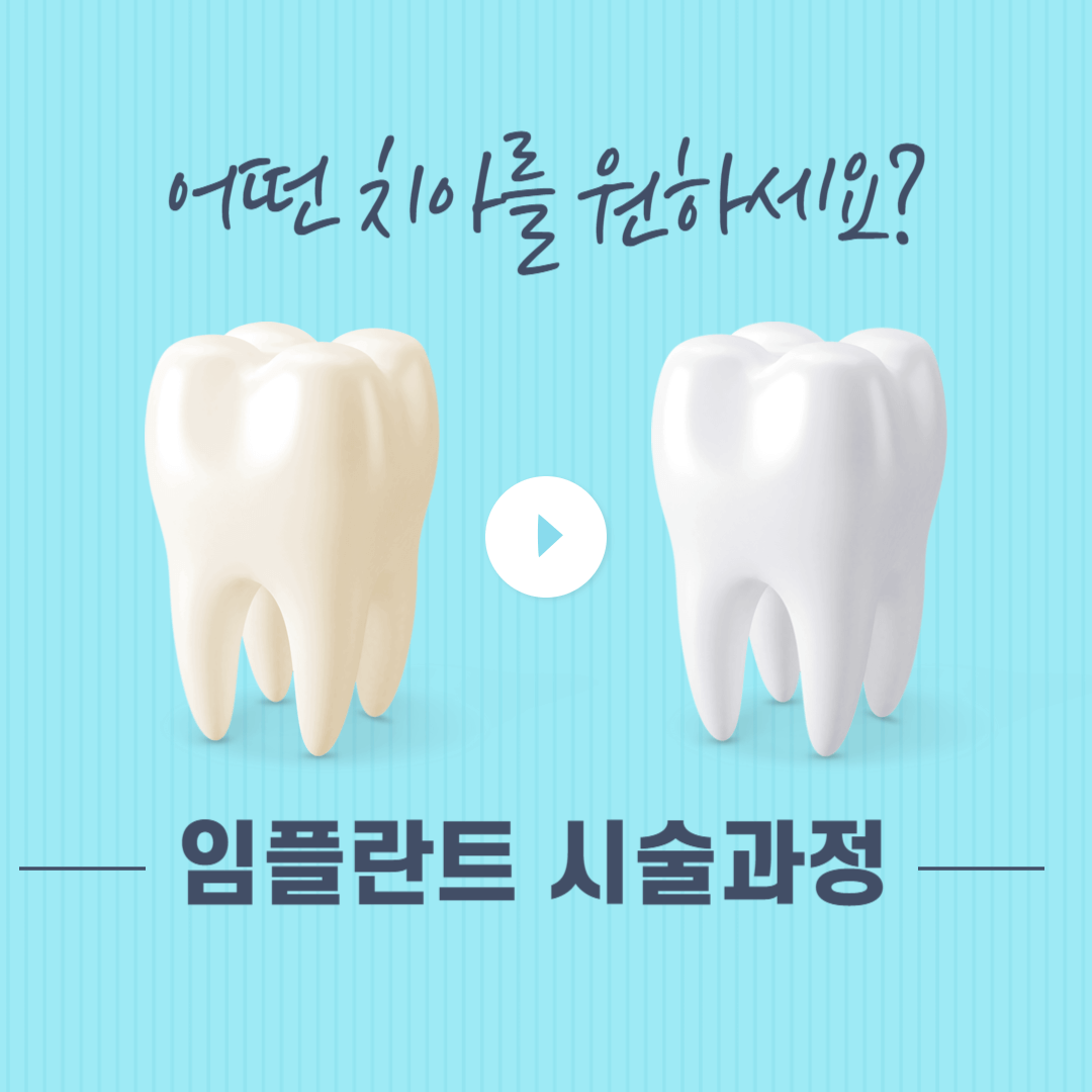 임플란트_시술과정