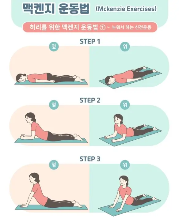 맥켄지