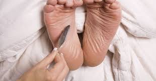 딸꾹질 멈추는 방법 10가지 원인 딸꾹질 멈추기 자주하는 오래가는 이유