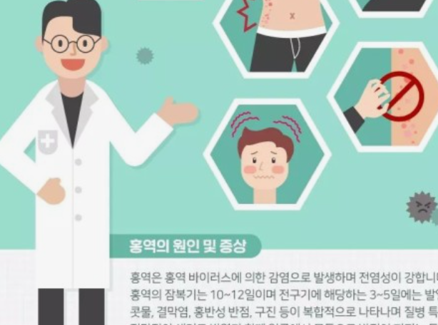 홍역-예방접종