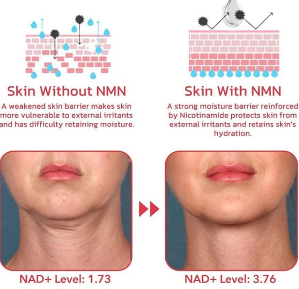 NAD⁺ 농도에따른 피부 주름 개선 효과