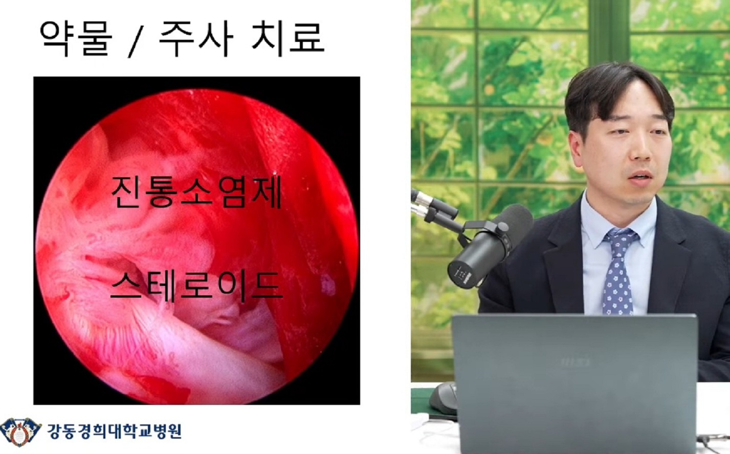 오십견-명의-김명서-