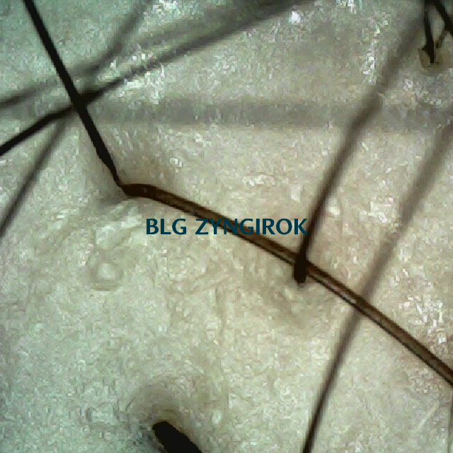 정수리와 이마사이 두피 모습이다.