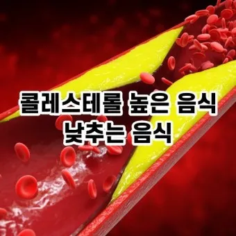 LDL 콜레스테롤 정상수치 낮추는법_4