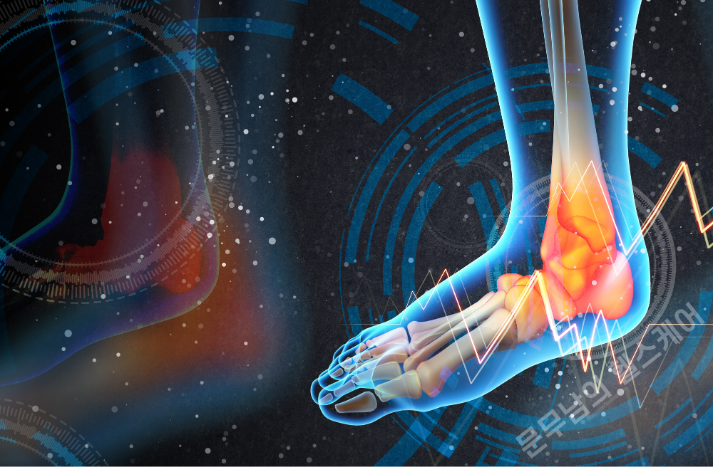 발목 터널 증후군 증상