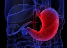 대장내시경-사진2