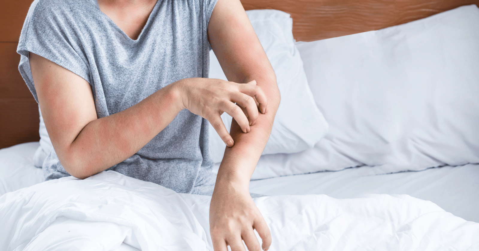 진드기물린후증상