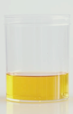 소변 색깔로 보는 건강