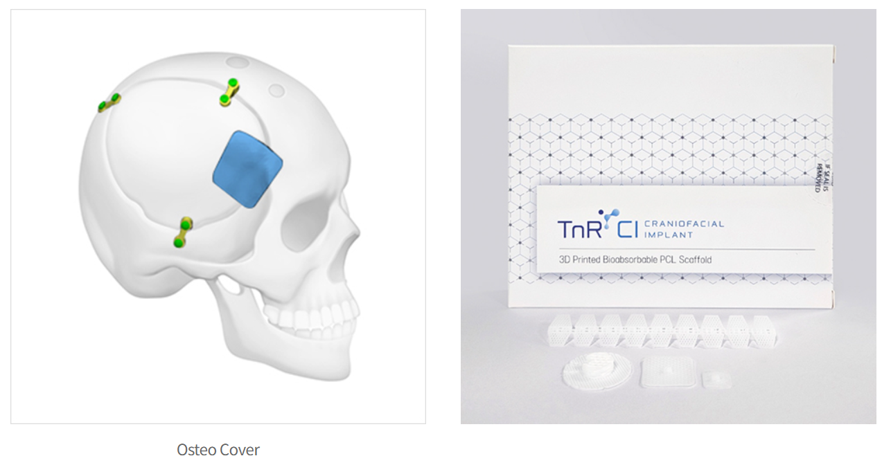 3D 프린팅 맞춤 의료기기의 미래, 국내 선도기업 3곳 집중 탐구