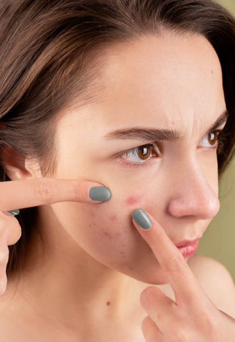 임신 중 피부 변화와 가능한 치료, 생활 관리